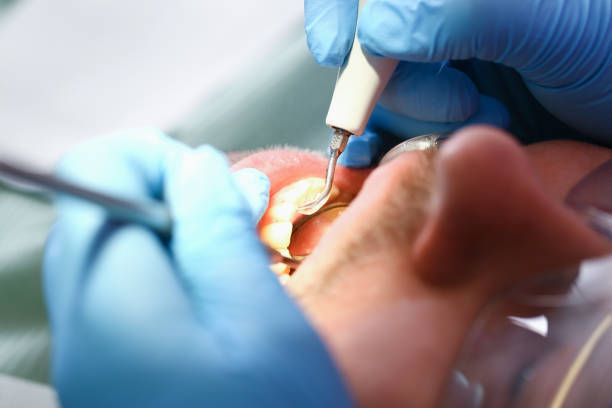 Best Emergency Root Canal Treatment in Coos Bay, OR