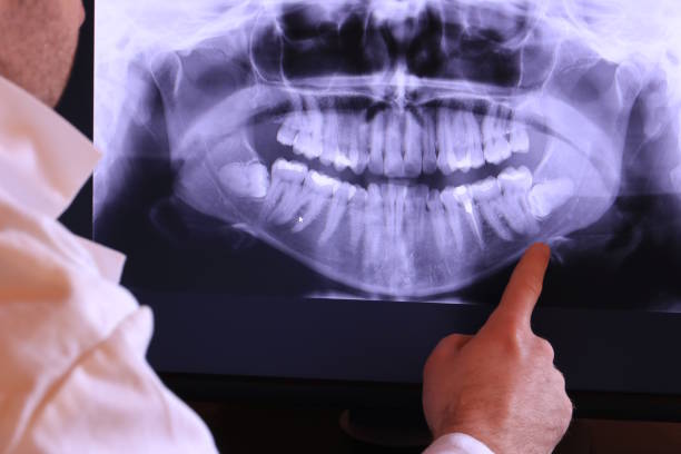 Best Emergency Dentist for Lost Fillings or Crowns in Coos Bay, OR